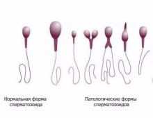 Where and how long do sperm mature?